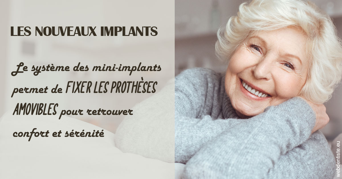 https://selarl-geyselinck.chirurgiens-dentistes.fr/Les nouveaux implants 1