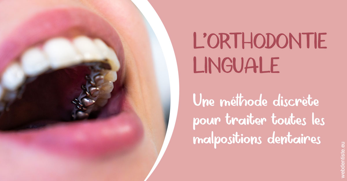 https://selarl-geyselinck.chirurgiens-dentistes.fr/L'orthodontie linguale 2