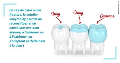 https://selarl-geyselinck.chirurgiens-dentistes.fr/L'INLAY ou l'ONLAY