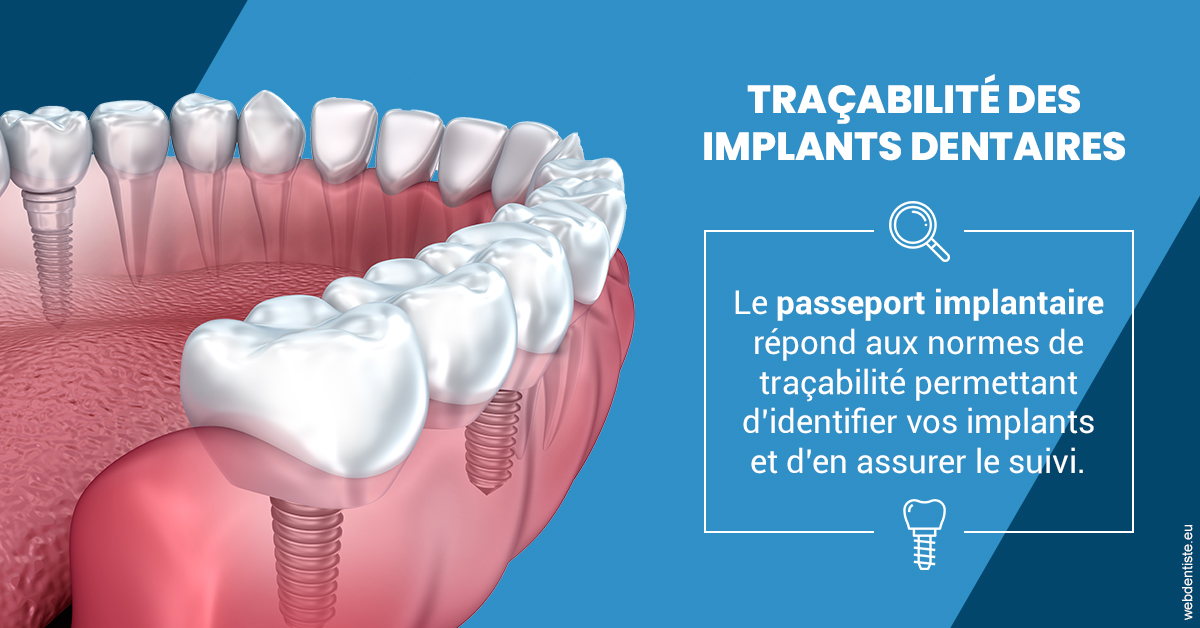 https://selarl-geyselinck.chirurgiens-dentistes.fr/T2 2023 - Traçabilité des implants 1