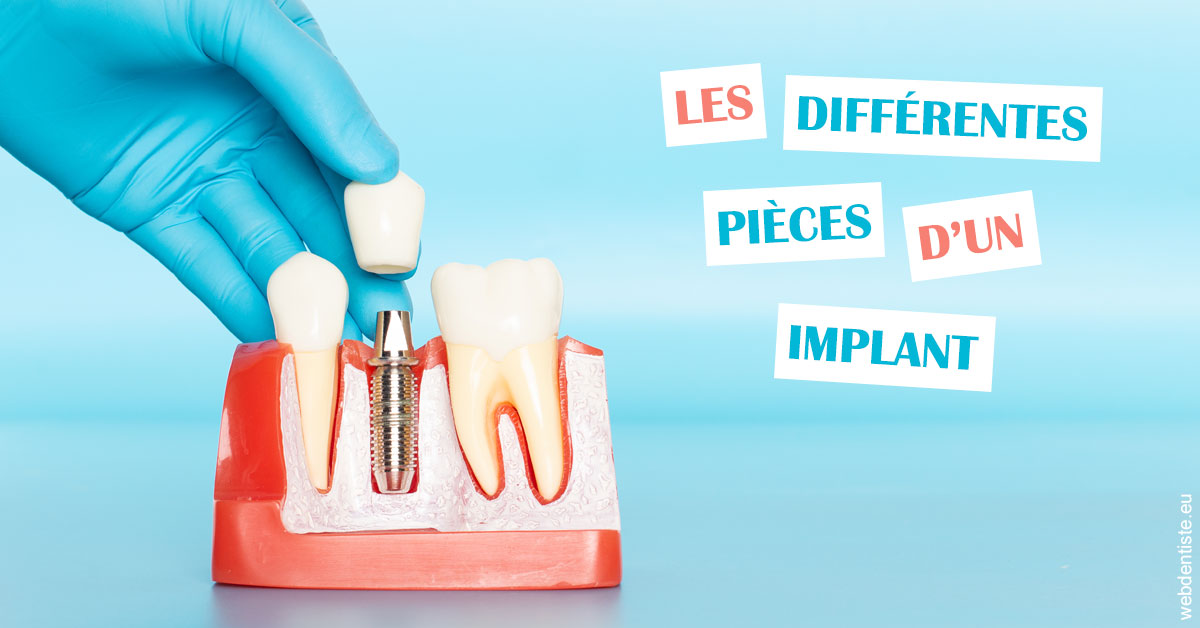 https://selarl-geyselinck.chirurgiens-dentistes.fr/Les différentes pièces d’un implant 2