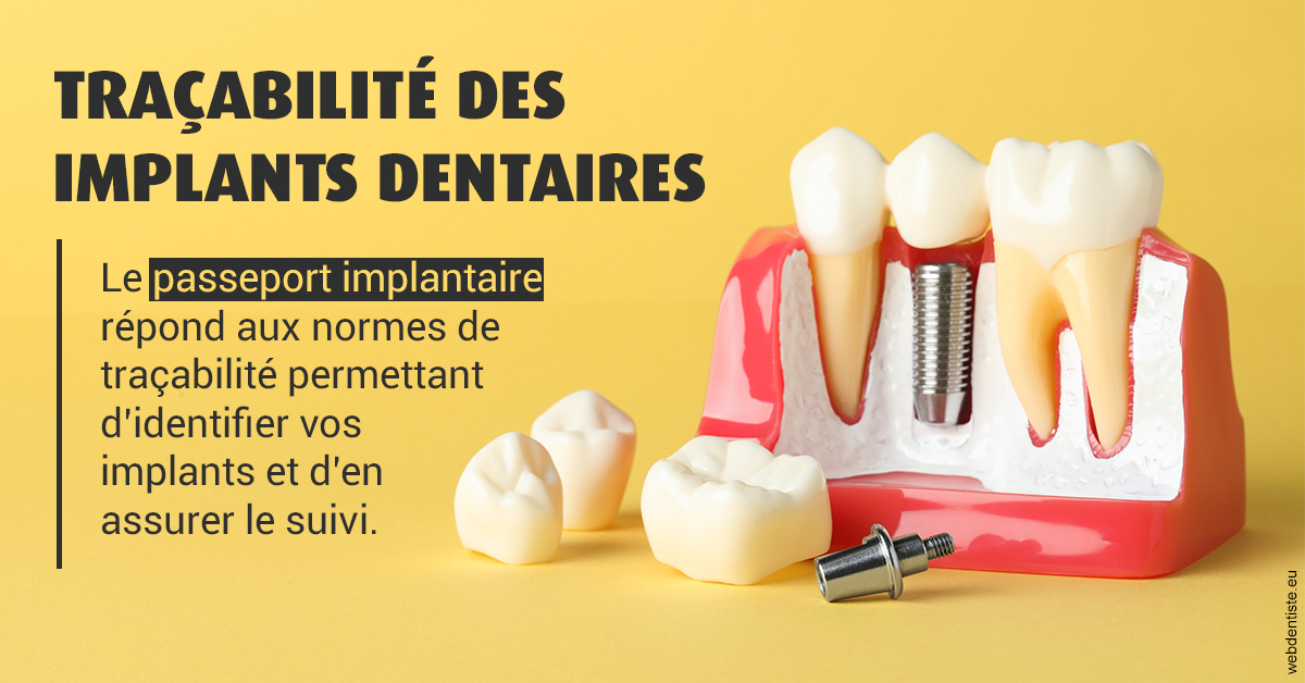 https://selarl-geyselinck.chirurgiens-dentistes.fr/T2 2023 - Traçabilité des implants 2